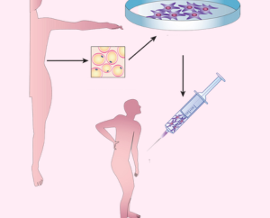 Medizinische und therapeutische Verwendung von Stammzellen