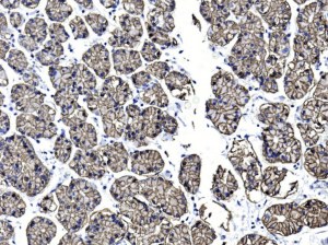 Nachweis von Claudin 18.2 mit optimierten IHC-Lösungen