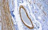 Anti-Smooth muscle myosin CE/IVD for IHC - Gynecological pathology