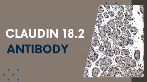 Claudin 18.2 Detection with Optimized IHC Solutions