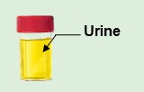 Urine exosome