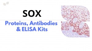 Impulse la investigación de enfermedades con proteínas SOX, anticuerpos y kits ELISA
