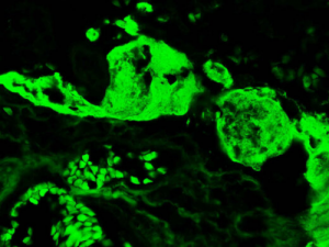 Migliorate la vostra diagnostica con gli anticorpi FITC