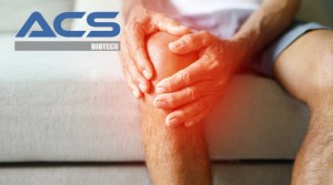 Cellule e tessuti umani osteoarticolari per la R&S