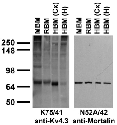 Immunoblots on brain membranes prepared from whole rat (RBM) and mouse (MBM) brain, and from human cerebral cortex [HBM(Cx)], and hippocampus [HBM(H)].