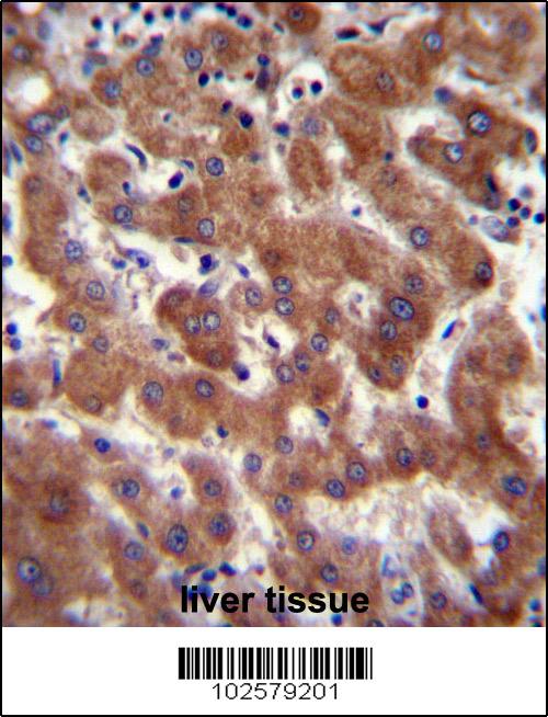 IHC-P - Androgen Receptor (ANDR) Antibody AP2509A