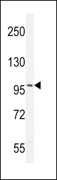 WB - Androgen Receptor (ANDR) Antibody AP2509A