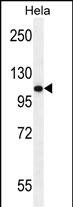 WB - Androgen Receptor (ANDR) Antibody AP2509A