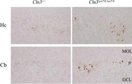 IHC-P - LC3 Antibody (APG8B) (N-term) AP1802A