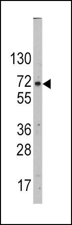 WB - GLUT2 (SLC2A2) Antibody (N-term) AP1489a