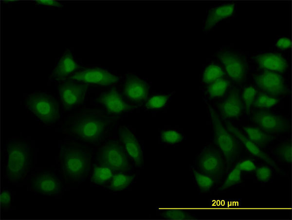 IF - JARID1B Antibody (monoclonal) (M02) AT2581a