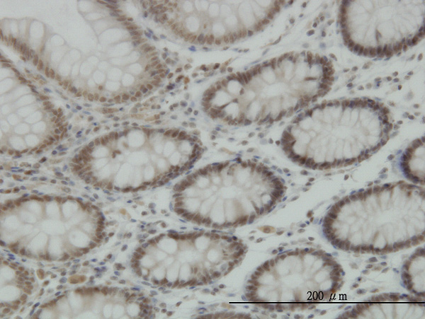 IHC - JARID1B Antibody (monoclonal) (M02) AT2581a