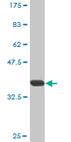 WB - JARID1B Antibody (monoclonal) (M02) AT2581a