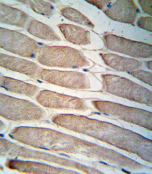 IHC-P - PDK4 Antibody (C-term) AP7041B