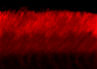 IHC - ABCA4 (Rim Protein) Antibody AN1167