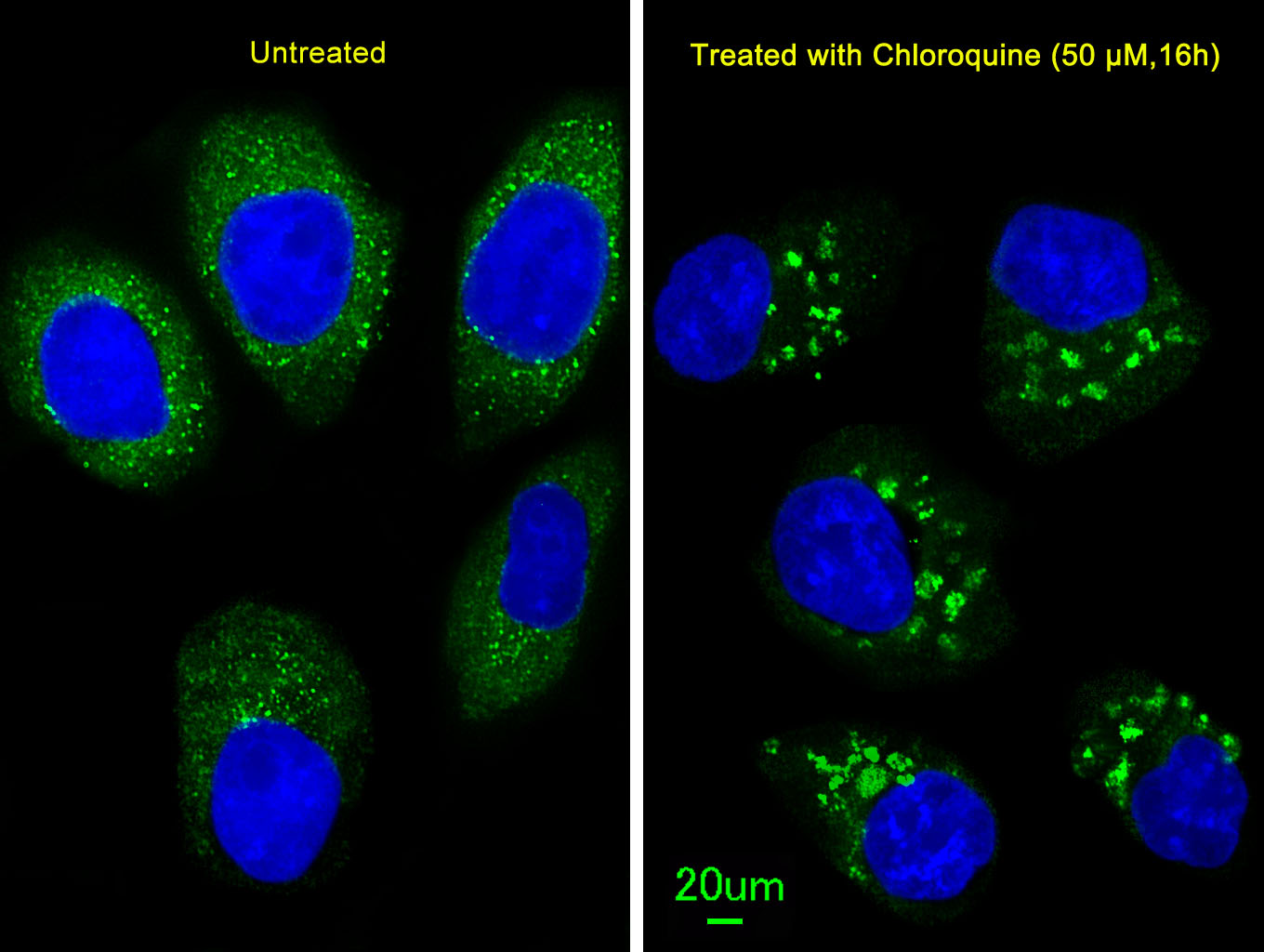 IF - LC3 Antibody (APG8B) (N-term) AP1802A