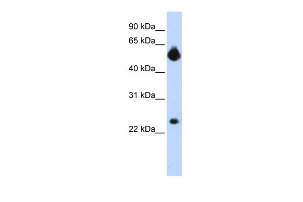 WB - NOTCH4 antibody - middle region AI10039