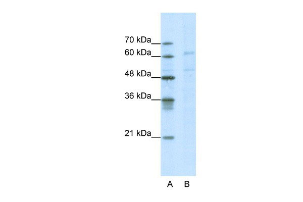 WB - CACNB3 antibody - C-terminal region AI10148