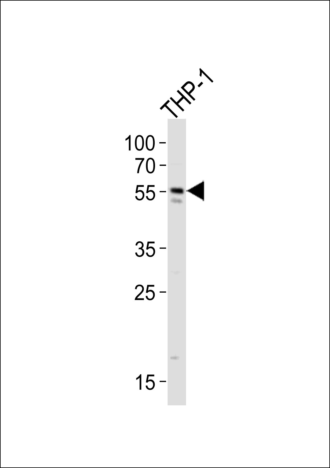 WB - CF150 Antibody  (Center) AP10510c