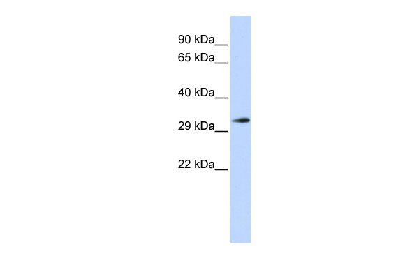 WB - FHL1 antibody - N-terminal region AI10285