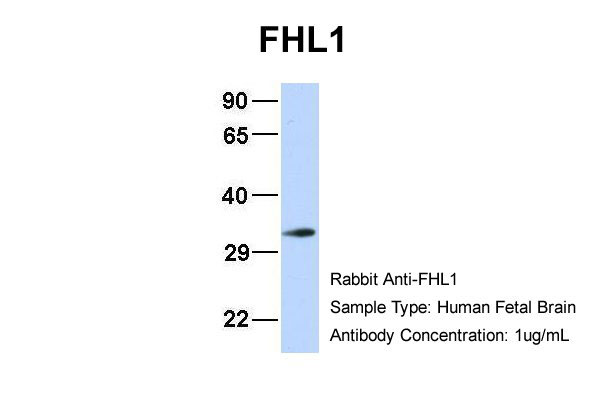 WB - FHL1 antibody - N-terminal region AI10285