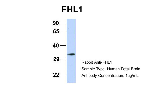 WB - FHL1 antibody - N-terminal region AI10285