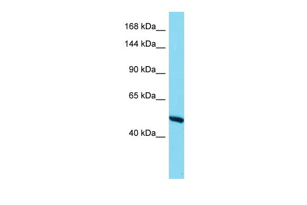 WB - RBM6 Antibody - C-terminal region AI10399