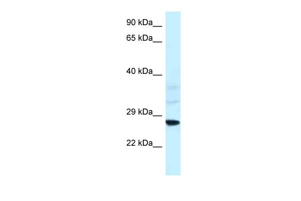 WB - Snf8 antibody - N-terminal region AI10426