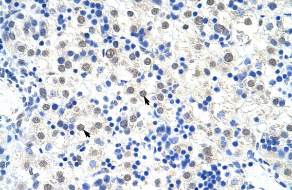 IHC - DDX47 antibody - C-terminal region AI11860