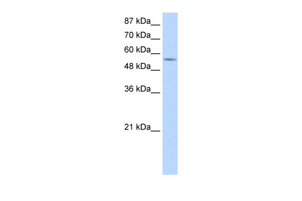 WB - DDX47 antibody - C-terminal region AI11860