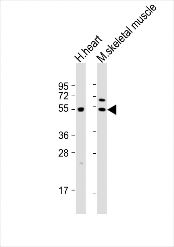 WB - PDK4 Antibody (C-term) AP7041B