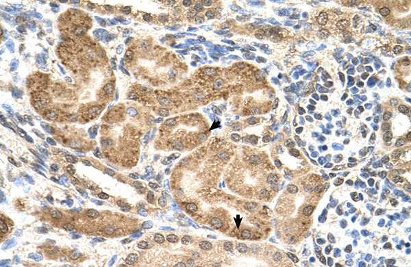 IHC - GMPPB antibody - C-terminal region AI12954