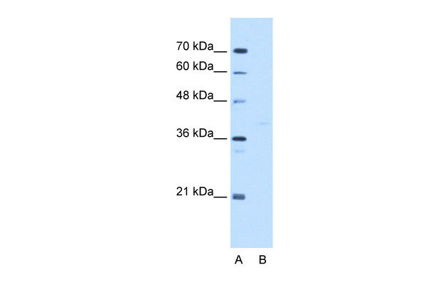 WB - GMPPB antibody - C-terminal region AI12954