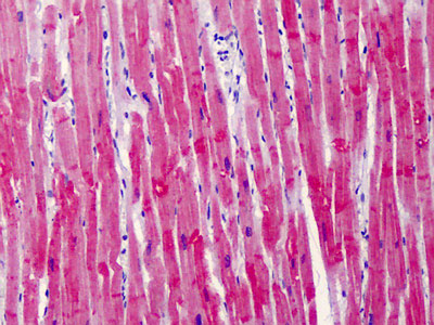 IHC - TNNT2 / CTNT Antibody (aa146-160) ALS13708