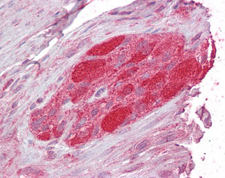 IHC - STUB1 / CHIP Antibody (C-Terminus) ALS14549