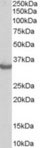 WB - STUB1 / CHIP Antibody (C-Terminus) ALS14549