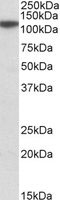 WB - FTHFSDC1 / MTHFD1L Antibody (Internal) ALS15860