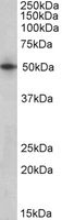 WB - SEPT4 / Septin 4 Antibody (Internal) ALS15388