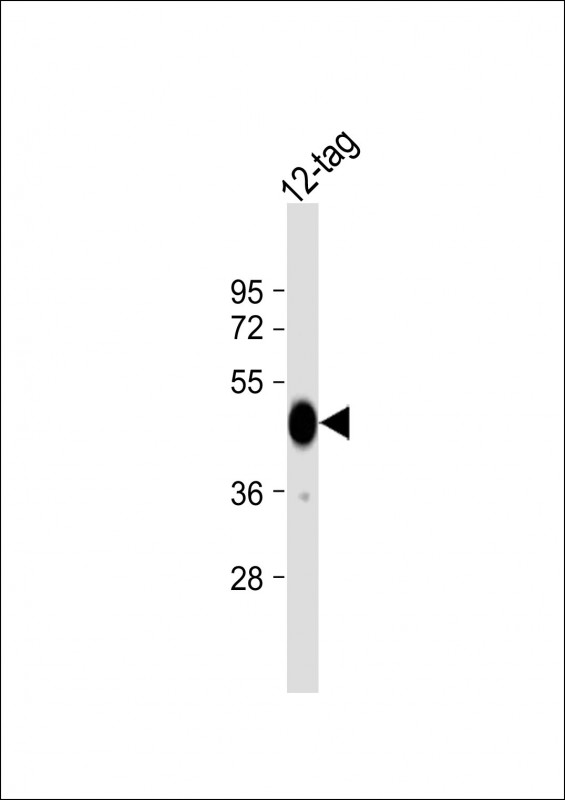 WB - HIS Tag Antibody, HRP Conjugate AM8499b