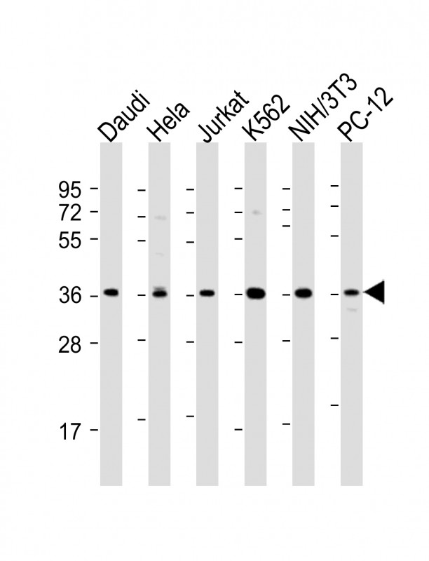 WB - IKB alpha (IKBA) Antibody AP2506a