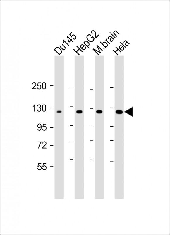 WB - DAB2IP Antibody AM8524b