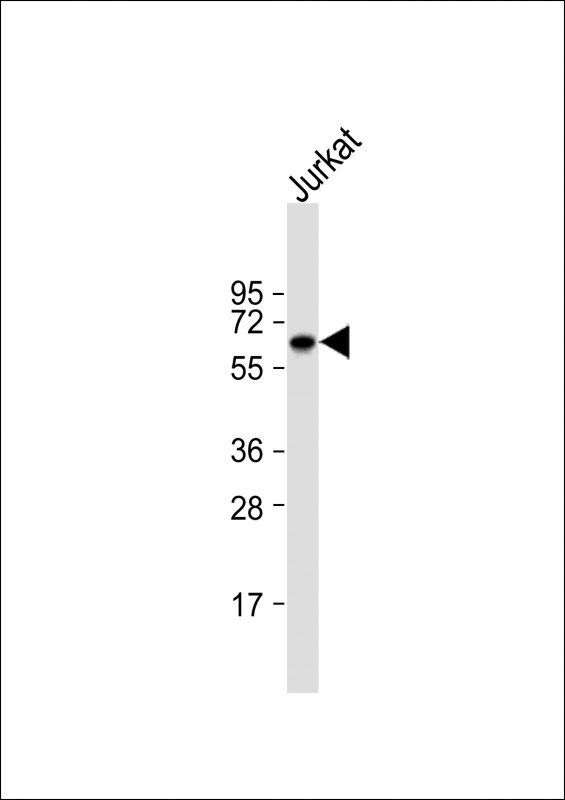 WB - GLUT2 (SLC2A2) Antibody (N-term) AP1489a