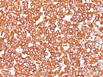 IHC -  Vimentin (Mesenchymal Cell Marker) Antibody - With BSA and Azide AH10809-20