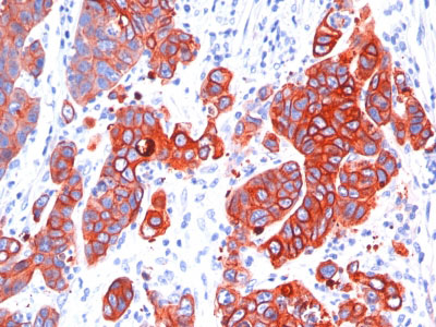 IHC -  Cytokeratin, Multi (Epithelial Marker) Antibody - With BSA and Azide AH10929-20