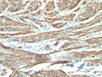 IHC -  Caldesmon, HMW (h-Caldesmon) (Smooth Muscle Marker) Antibody - With BSA and Azide AH12566-20