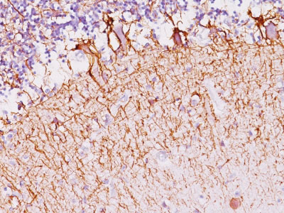 IHC -  Neurofilament (H+L) (Neuronal Marker) Antibody - With BSA and Azide AH13005-20