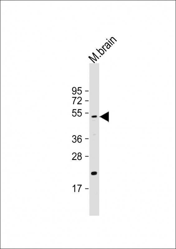 WB - HtrA1 Antibody (N-term) AP1331A