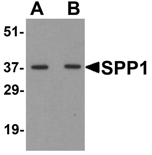 WB - SPP1 Antibody ASC11685