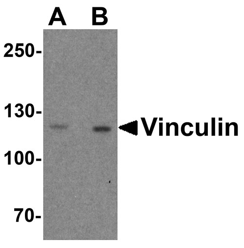 WB - Vinculin Antibody  ASC11704