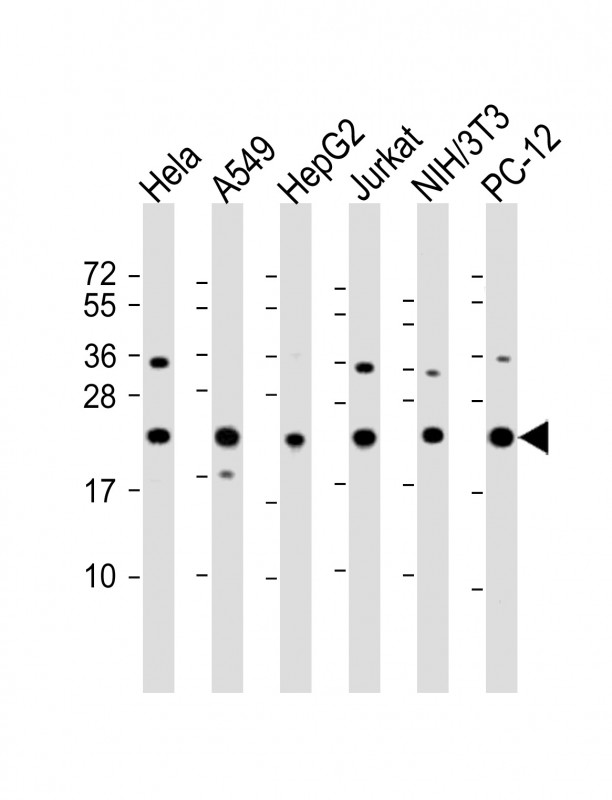 WB - RPS7 Antibody (C-Term) AP22078b